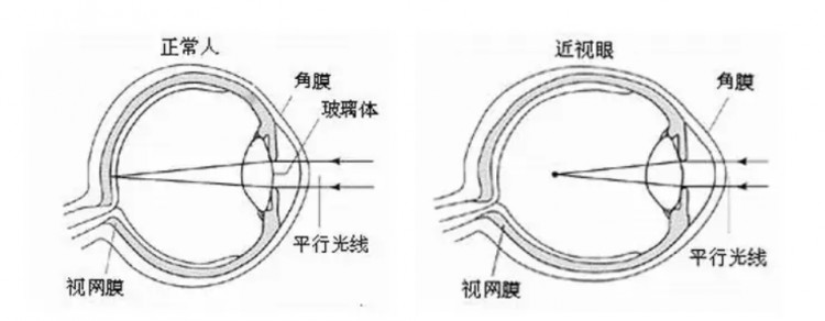 欧普康视——帮眼睛做个SPA毛利堪比茅台